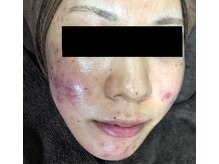 ココティー 金沢駅前店(Cocotii)/グリーンピールスペシャル1day 