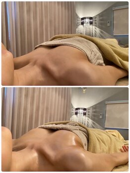 美人バスト 吉祥寺店/バストアップ　★☆症例写真☆★