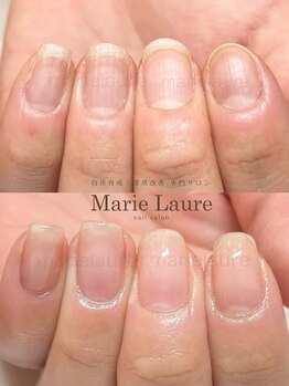 マリーロール 梅田店(Marie Laure)/深爪矯正/自爪育成/自爪風