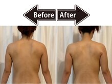 シェリ(Cherie)/1回でスッキリ◎華奢なラインへ