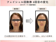 オーク ナチュリ 成城学園前(OAK×NACHUL)の雰囲気（小顔/たるみに特化したオリジナル×高性能マシンで整った小顔）