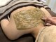 サロン アグランシュ(salon A.glansh)の写真/背中ニキビケアに★【ヒト幹細胞+プラズマ+モデリングパック¥5,000】結婚式や夏のイベント前に♪