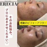 エレシア(ERECIA)