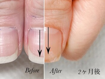 トゥインクリーネイルサロン(Twinkly Nail Salon)/【最強のネイルケア】1回お試し