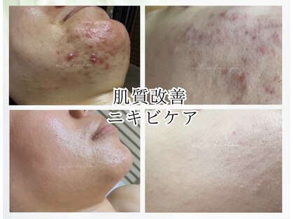 ミーラブ 鹿児島(miilove)の写真