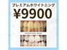 【プレミアムホワイトニング】高い効果を得たい方☆プレミアム45分照射¥9,900