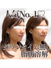 ミタメ 銀座店(MITAME)/モデルから絶大支持♪小顔ケア