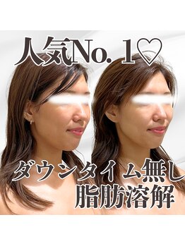 ミタメ 銀座店(MITAME)/モデルから絶大支持♪小顔ケア
