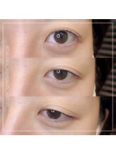 ラウレア(Laule’a)/まつげパーマ