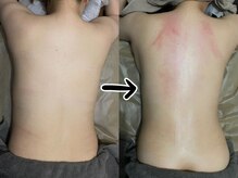 あくび 西麻布(aqu美)/美容整体融合アロマオイルリンパ