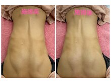 ハナノ整体院/背骨の歪みを矯正中