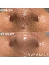 ルココン エミュ(le cocon e'mue)/ミシア式毛穴ケア