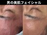 エグゼクティブ【極上肌へのご褒美】リンパ/マッサージケア◎　¥22000