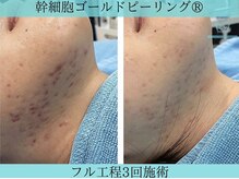 リメイククリニカルビューティー(Remake clinical beauty)/