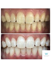 ホワイトニングショップ 奈良生駒店/笑顔に自信を！