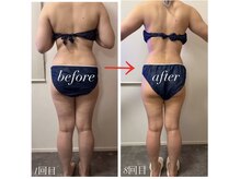 エードット(A.)/1回目→8回目