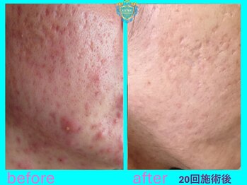 リュクス(LUXE)/ビフォーアフター