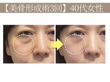 ドクターボディ 恵比寿店(Dr.Body)の雰囲気（【目の下のたるみ/目の下のクマ】オーダーメイド性 小顔/恵比寿）