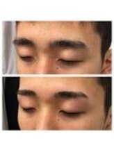 アイビー 神保町店(i.b)/眉【before⇒after】６