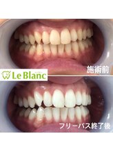 ルブラン 奈良店(Le Blanc)/Xmasプレゼントに！