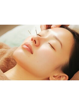 鍼灸施術を受けたい