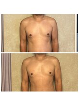 りんと/男性にかたも