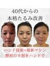 【院長指名】日本で数名の技術！美骨形成術で最高のエイジングケアを！