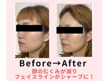 ココロ(COCORO)/美脳小顔矯正＆毛穴洗浄