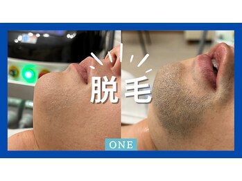 ワン(ONE)/脱毛