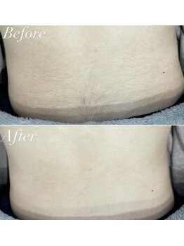 ベイビースキン(Baby skin)/メンズの方も大歓迎◎