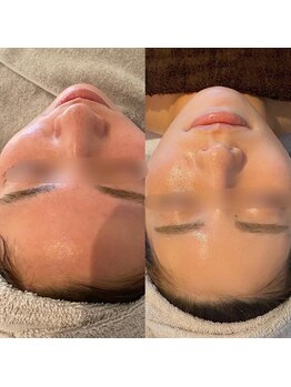 シャイネル(SHYNELL)/