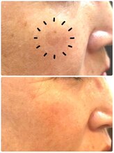 福屋。 指宿店/シミケア