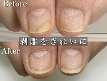 リリー/剥離をきれいに