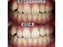 ヤット 森ノ宮(yatto.)/10代男性