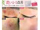 サロンドエステケイワイ(de KY)の写真