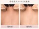 トリプルサンショップ 京都店の写真/【京都/烏丸】挙式前の花嫁美容に。フェイシャルも二の腕・背中・ウエストもまとめて集中ケア