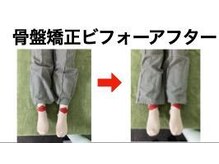 やち鍼灸院/骨盤矯正で腰痛予防も！