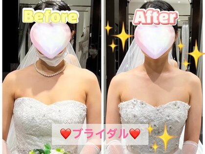 リシャイン(Reshine)の写真