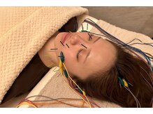 デルタエヌピー63+(δnp63+)/小顔電気鍼[薬院/フェイシャル]