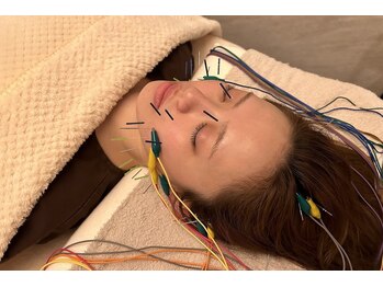 デルタエヌピー63+(δnp63+)/小顔電気鍼[薬院/フェイシャル]