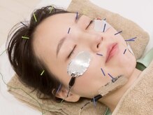 御茶の水ドライN鍼灸
