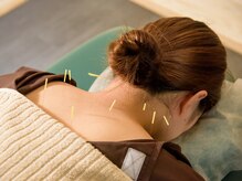 キート美容鍼灸 整体院(Kiito美容鍼灸 整体院)/全身の鍼～肩～