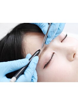 顔脱毛がしたい