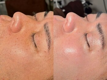 ルーナジェーナ(Luna llena)/池袋/目白/雑司ヶ谷/エステ