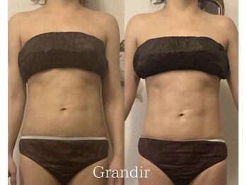 グランディール(GRANDIR)/【痩身】上半身コース5回