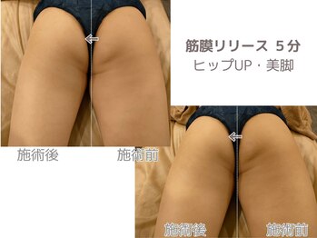 シェルサロン(Shell Salon)/ヒップアップ