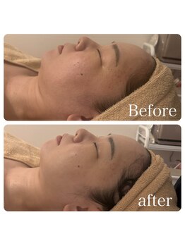 パールムーン(pearl moon)/タラソトリートメント