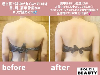ソレイユビューティー 愛知大学前(SOLEIL BEAUTY)/お背中別人級♪