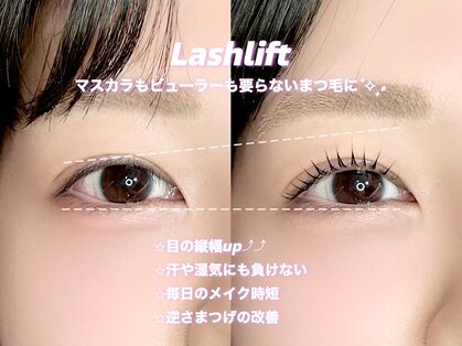 ルナ(Luna)の写真
