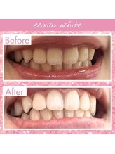 エクシアホワイトニング 王寺店/